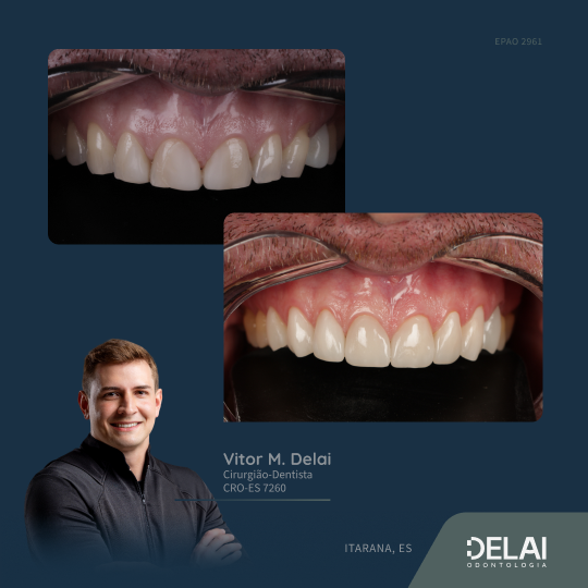 Frame 14delai-odonto_web