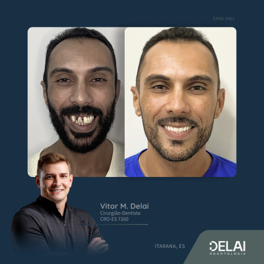 Frame 15delai-odonto_web