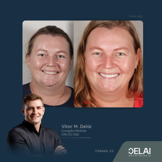 Frame 20delai-odonto_web